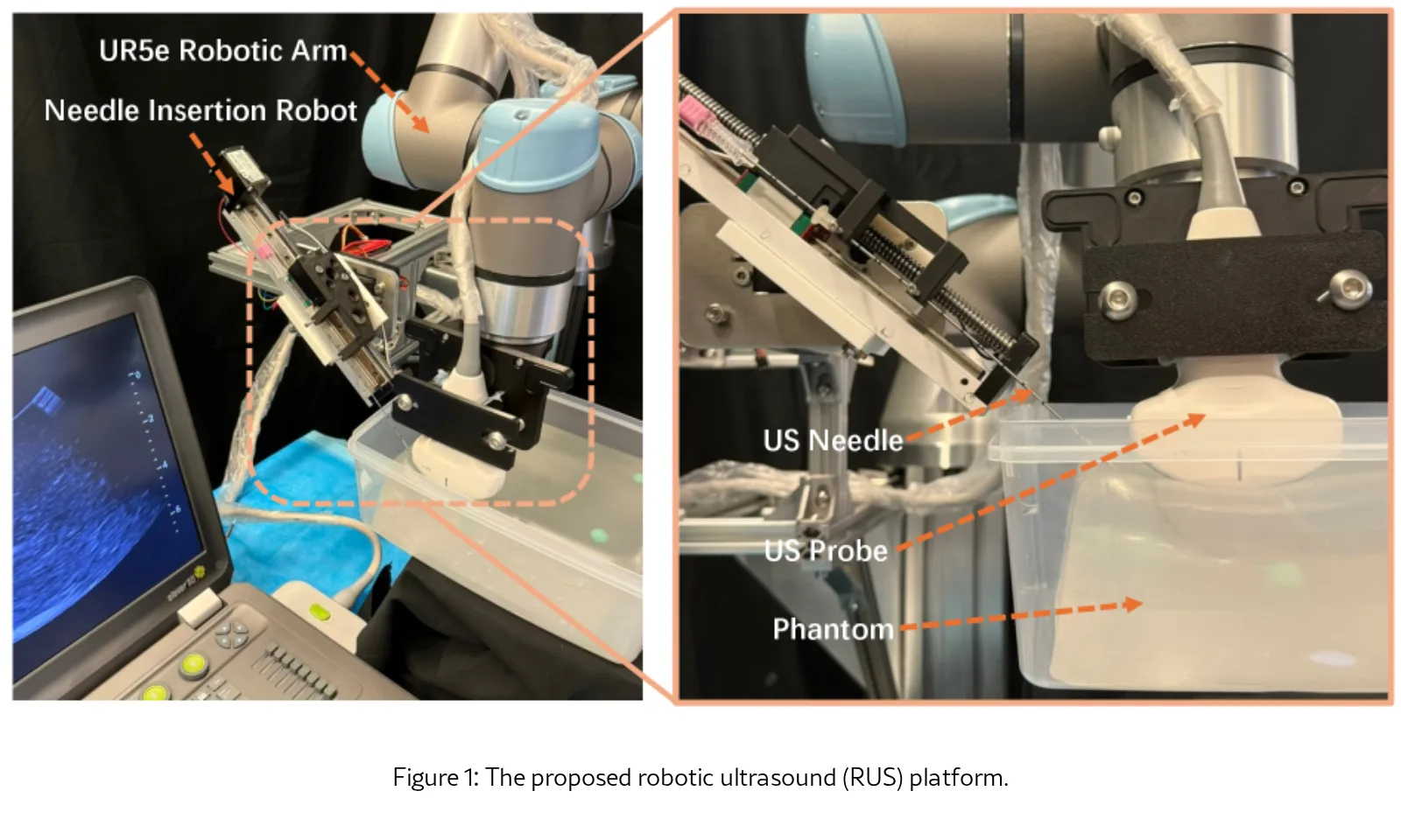 A Vision-Language-Action Model for Adaptive Ultrasound-Guided Needle Insertion and Needle Tracking